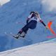 Vonn could have lost leg in Olympic accident